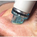 hydrafacial (1)